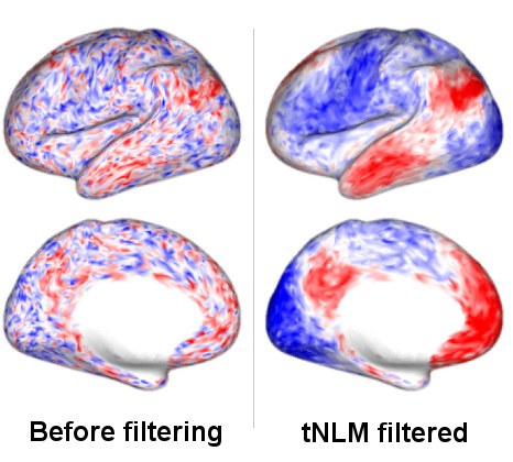 tNLM output